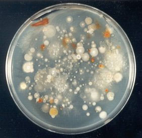 Культура почвенных бактерий