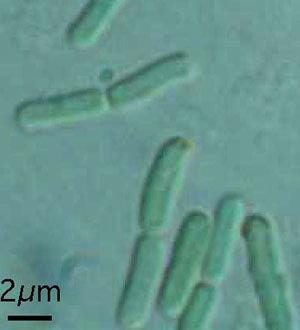Thermosynechococcus elongatus