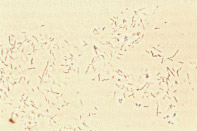 Campylobakter