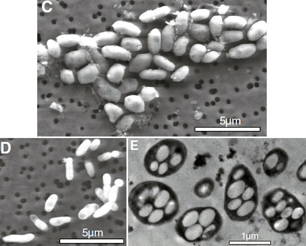 бактерии под электронным микроскопом
